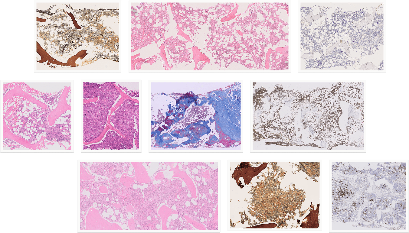 Bone marrow microscopy grid showing cellular structure